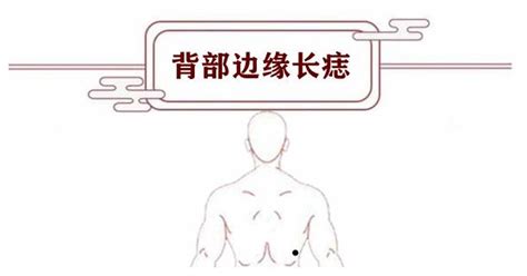 背部痣吉凶